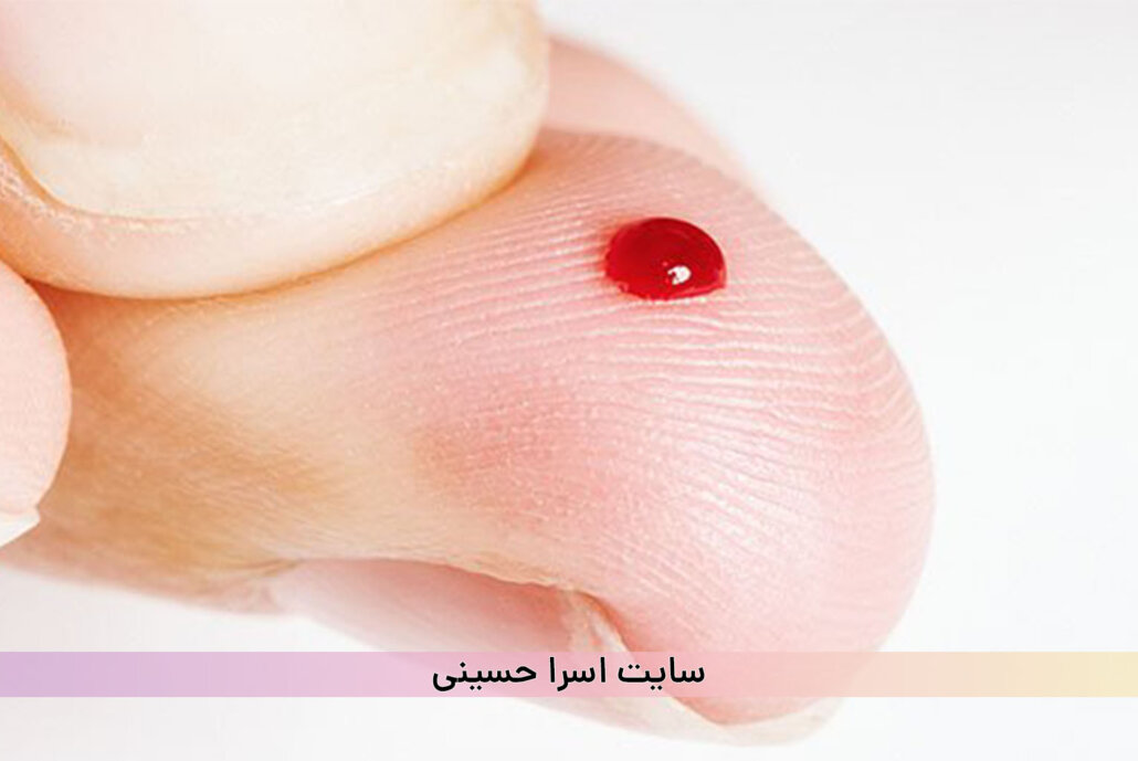 نیدل استیک شدن برخورد سوزن مشتری به بدن پیگمنتر