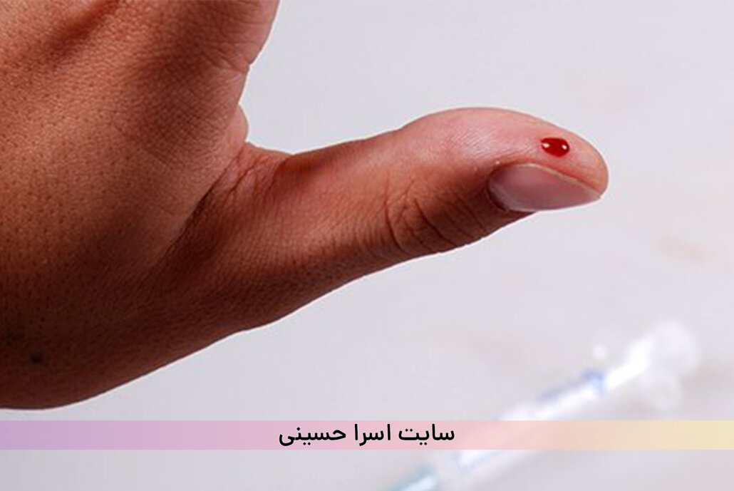 نیدل استیک برخورد سوزن مشتری به بدن تتوکار