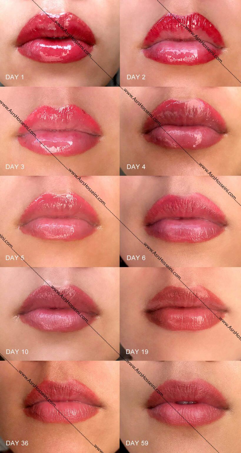 میکروپیگمنتیشن لب چیست آکادمی اسرا حسینی