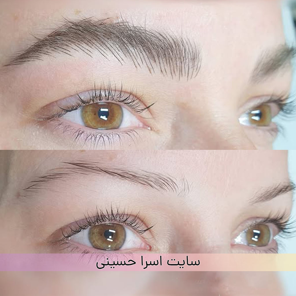تفاوت فیبروز و نانوبروز