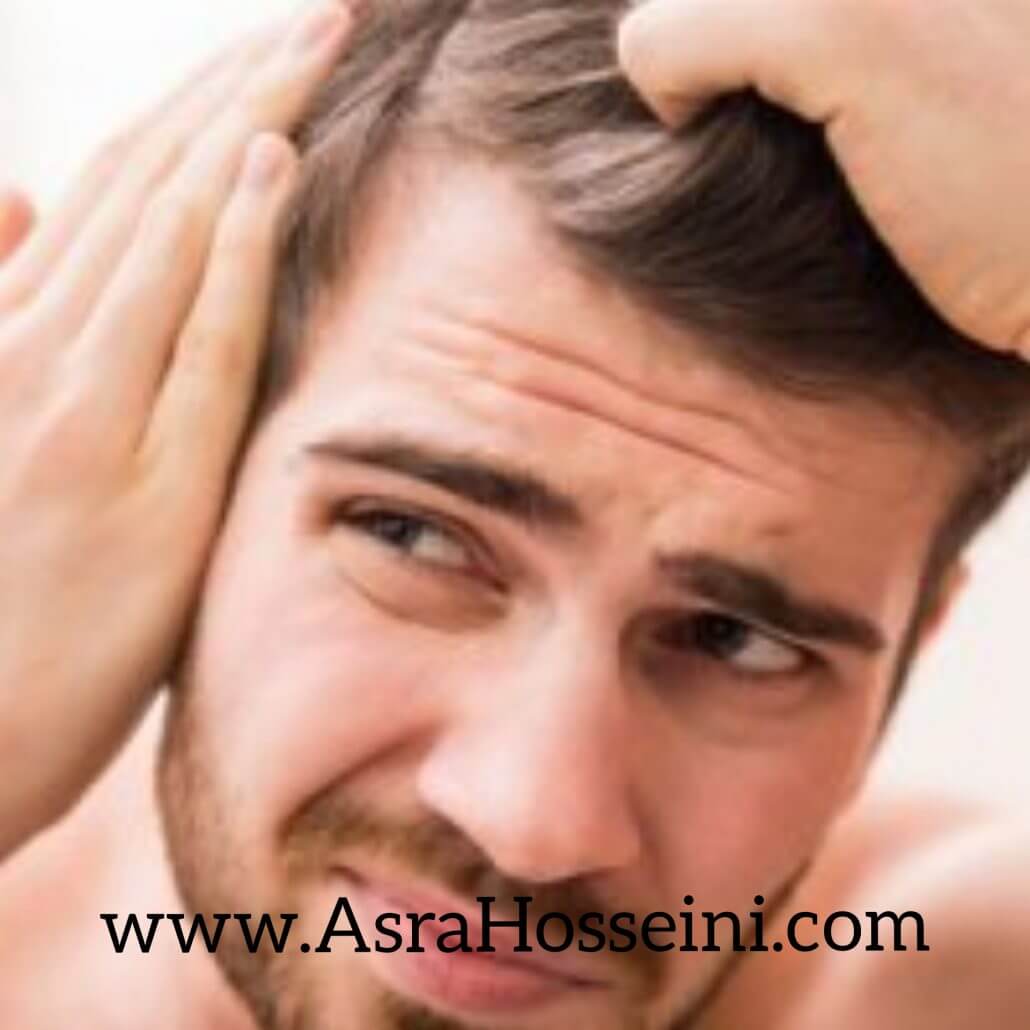 عوامل ریزش مو در مردان 