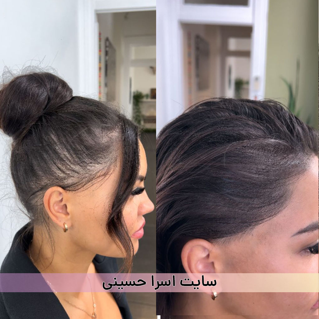 اسکالپ سر خانم ها